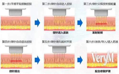 清潭OK皮膚科趙希恩院長的分層抗衰老美學理念